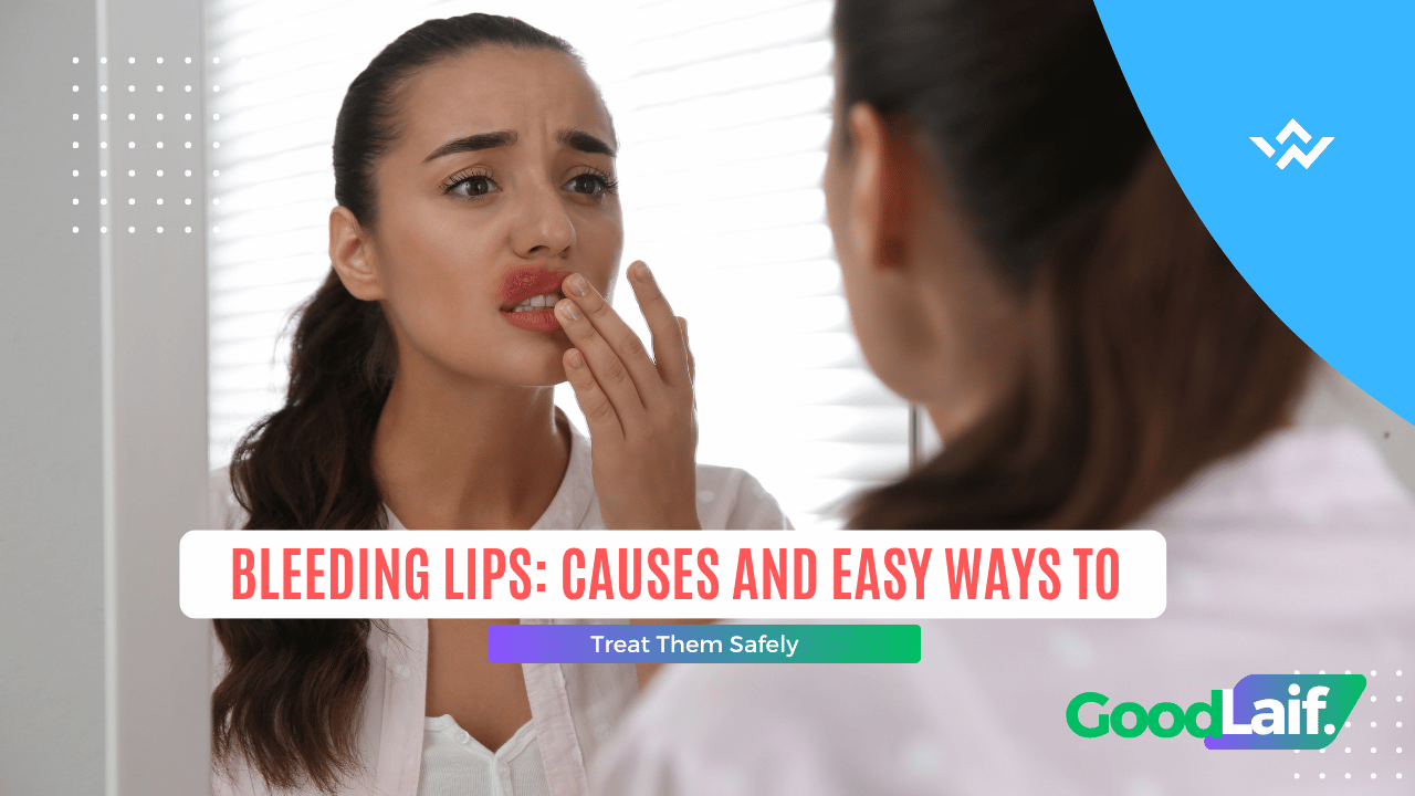 Woman looking in the mirror while touching her lips, illustration of bleeding lips causes and how to treat them