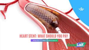 Illustration of heart stent procedure in a coronary artery