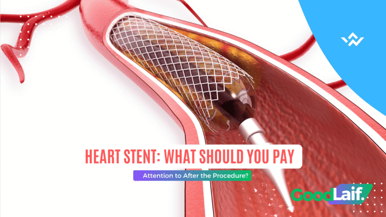 Heart Stent: What Should You Pay Attention to After the Procedure?