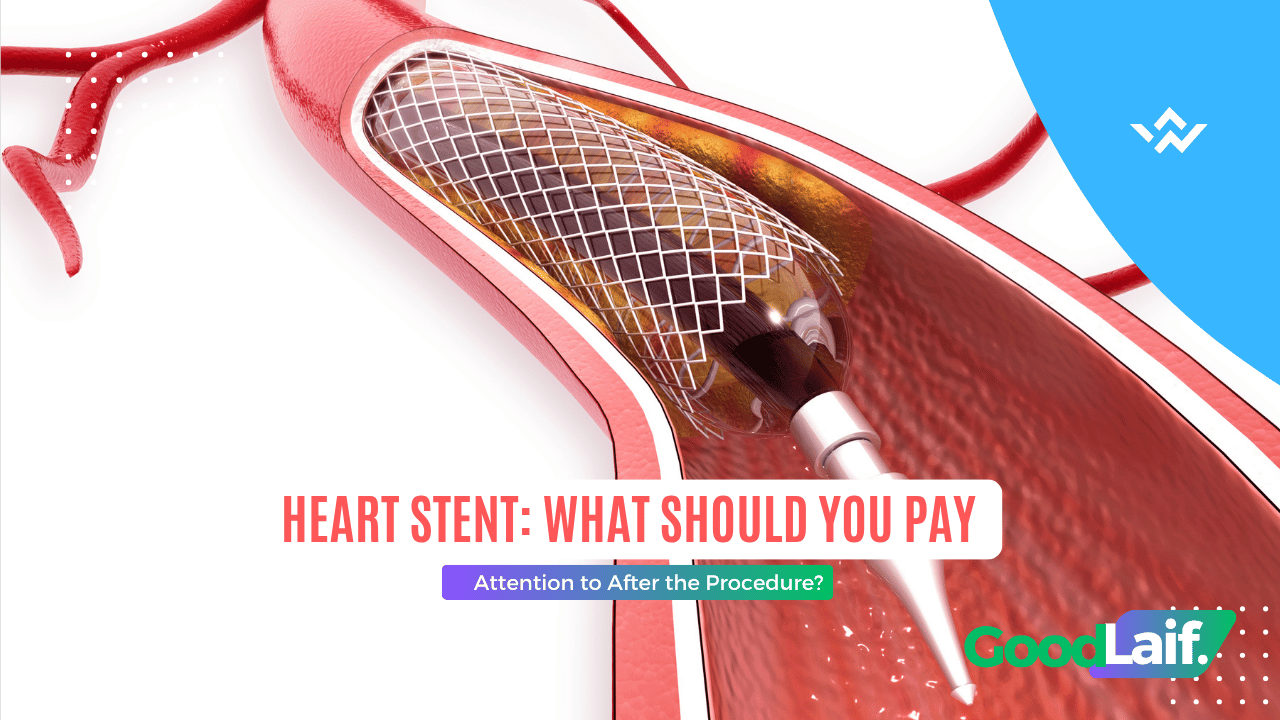 Illustration of heart stent procedure in a coronary artery