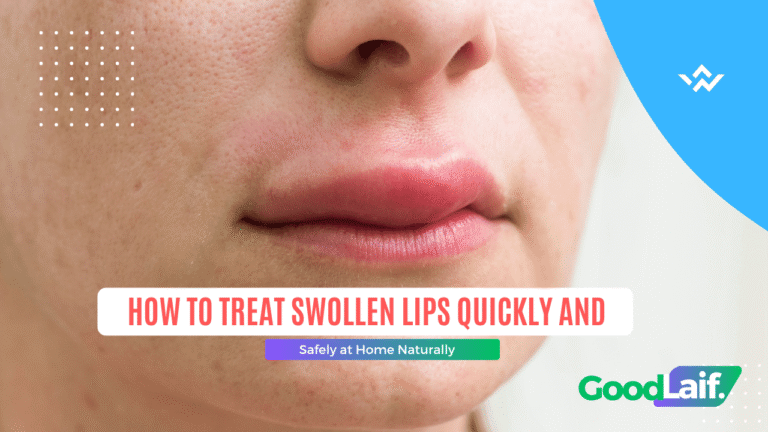How to Treat Swollen Lips Quickly and Safely at Home Naturally