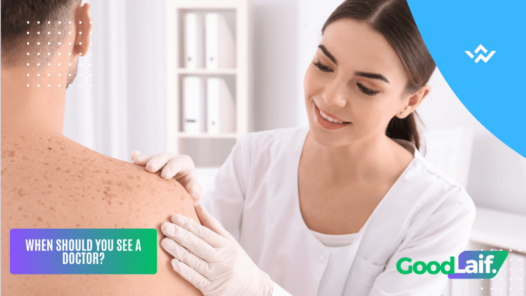 Consulting a dermatologist for proper back acne treatment