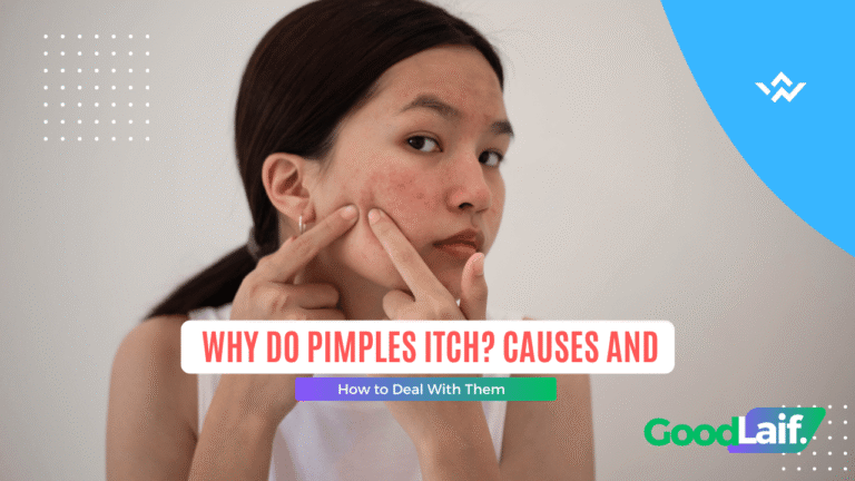 Why Do Pimples Itch? Causes and How to Deal With Them